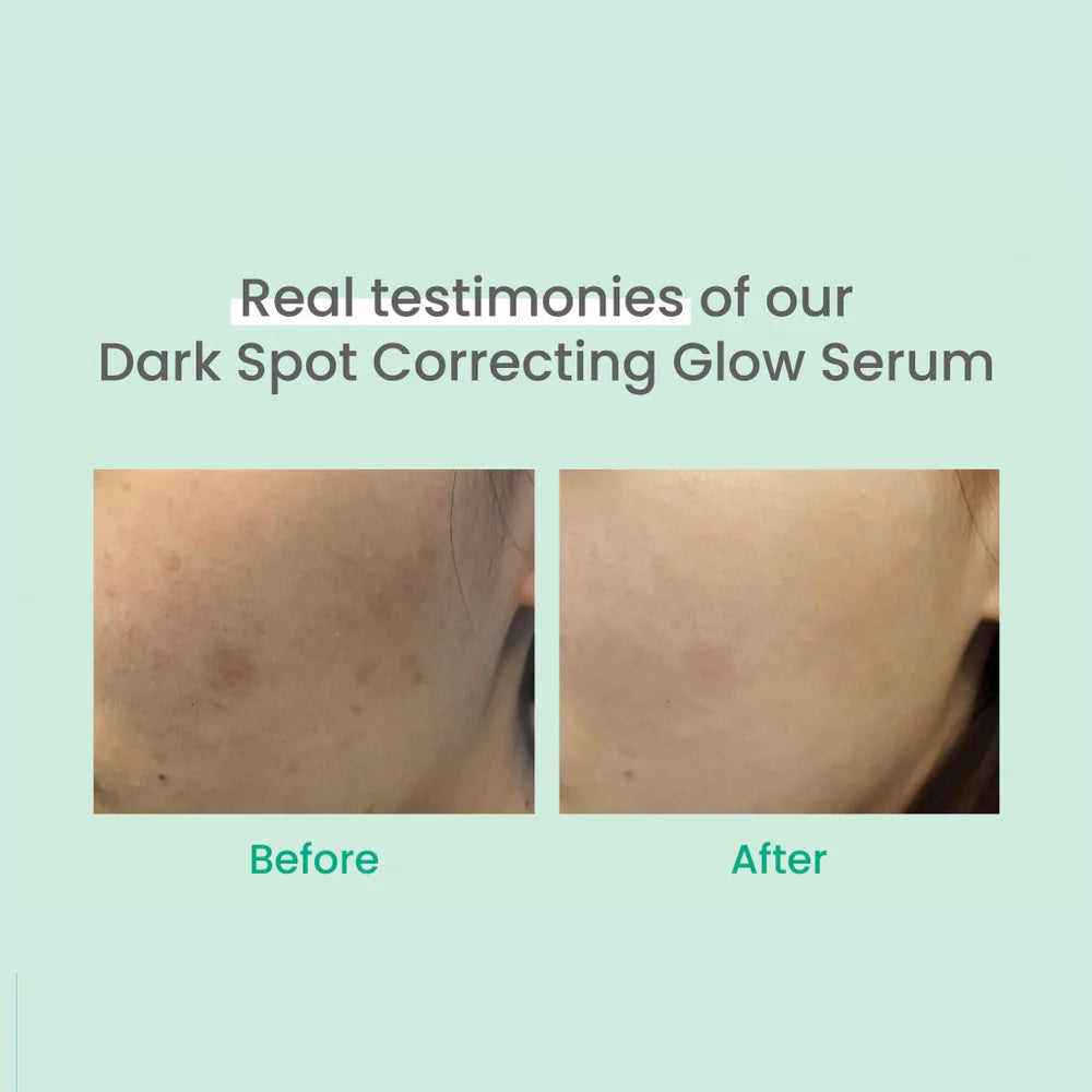 Dark Spot Correcting Glow Serum 50ml